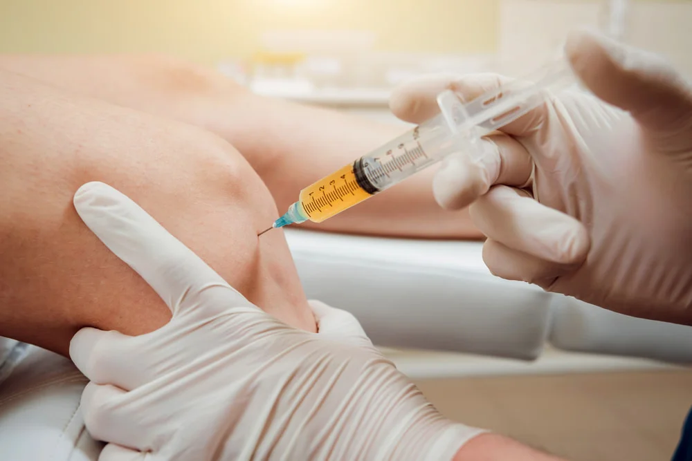Tratamentos por PRP (plasma rico em plaquetas)